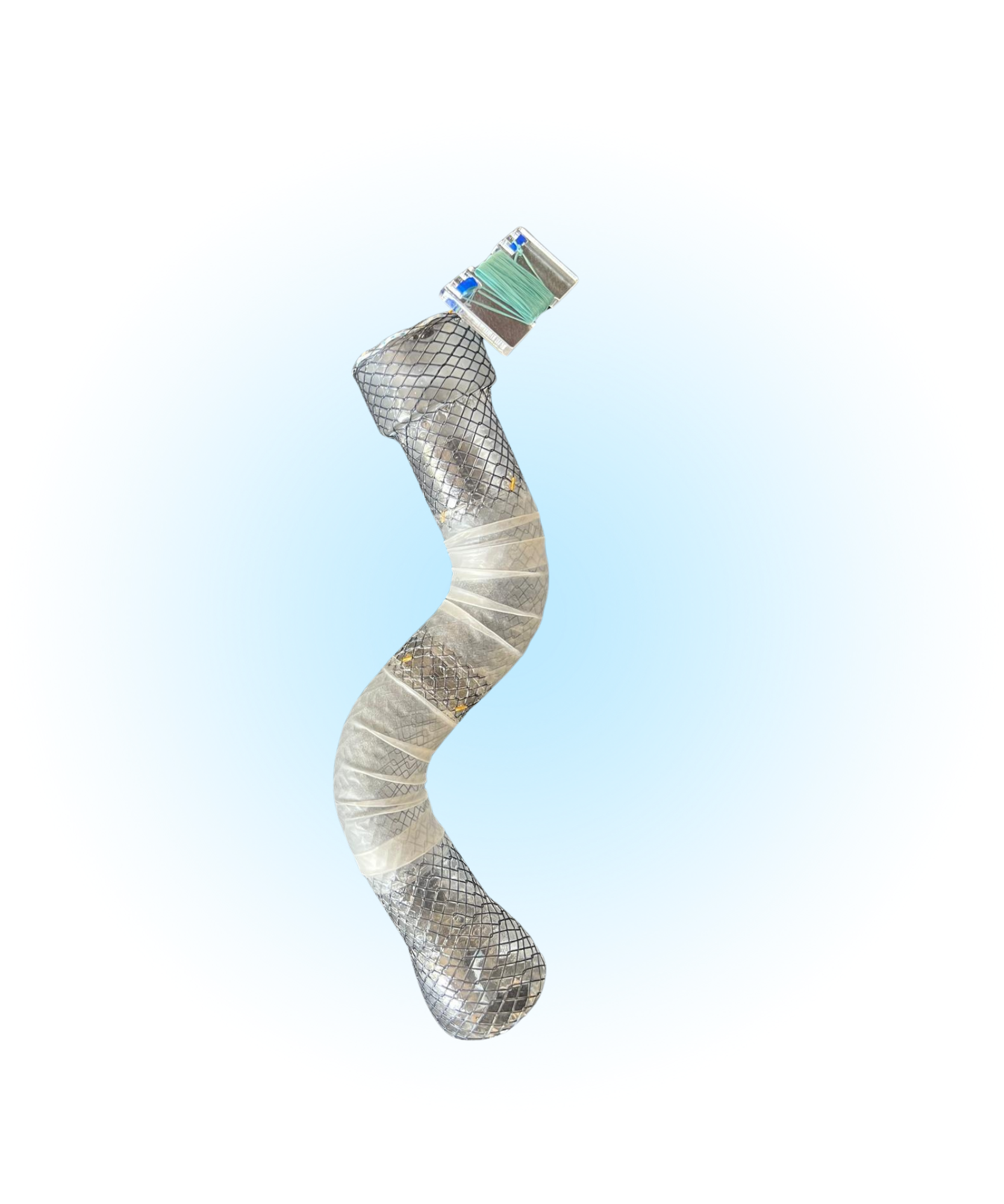 Bariatrik Metal Stentler