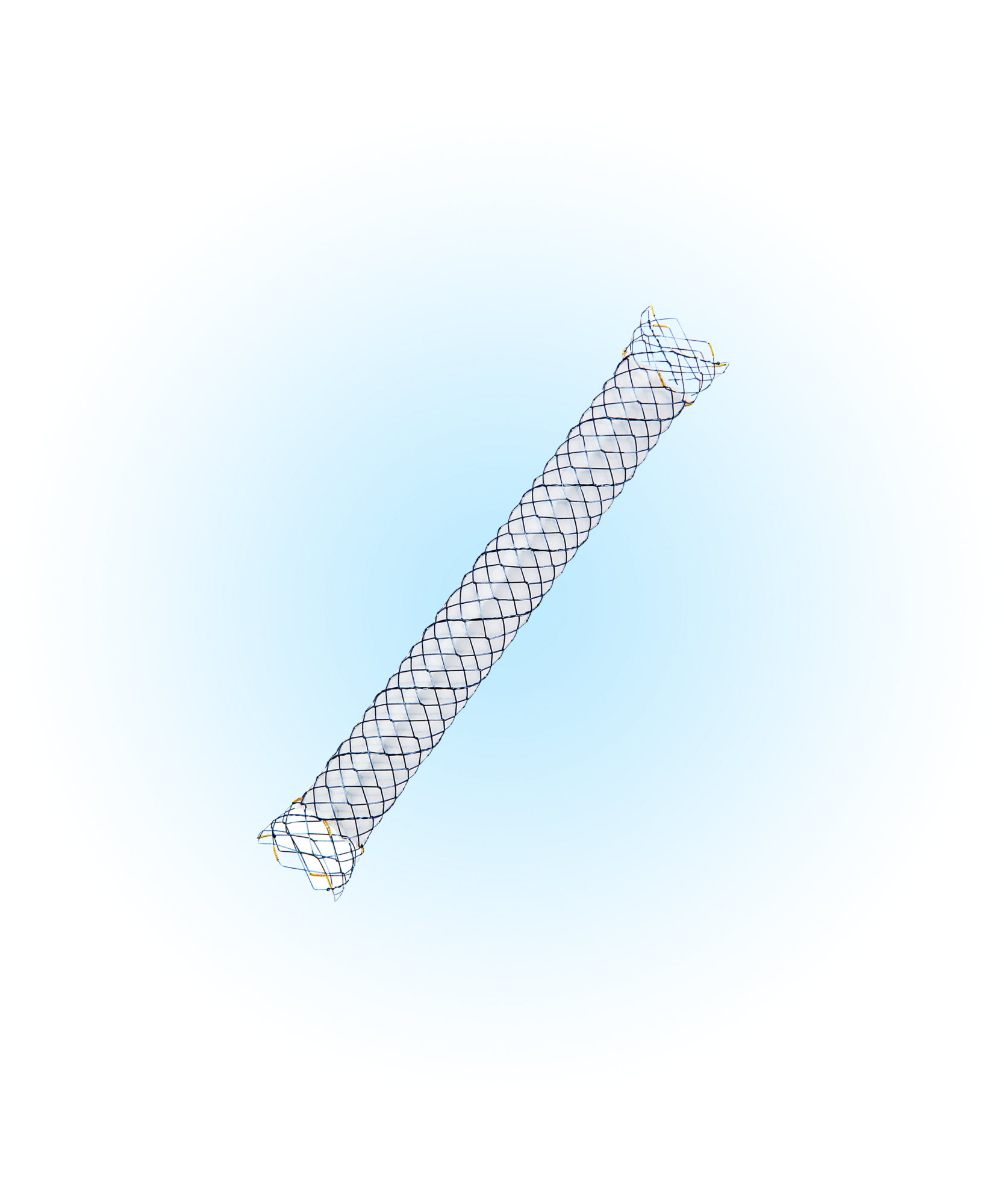 BPA Biliyer Yarı Kaplı Stent
