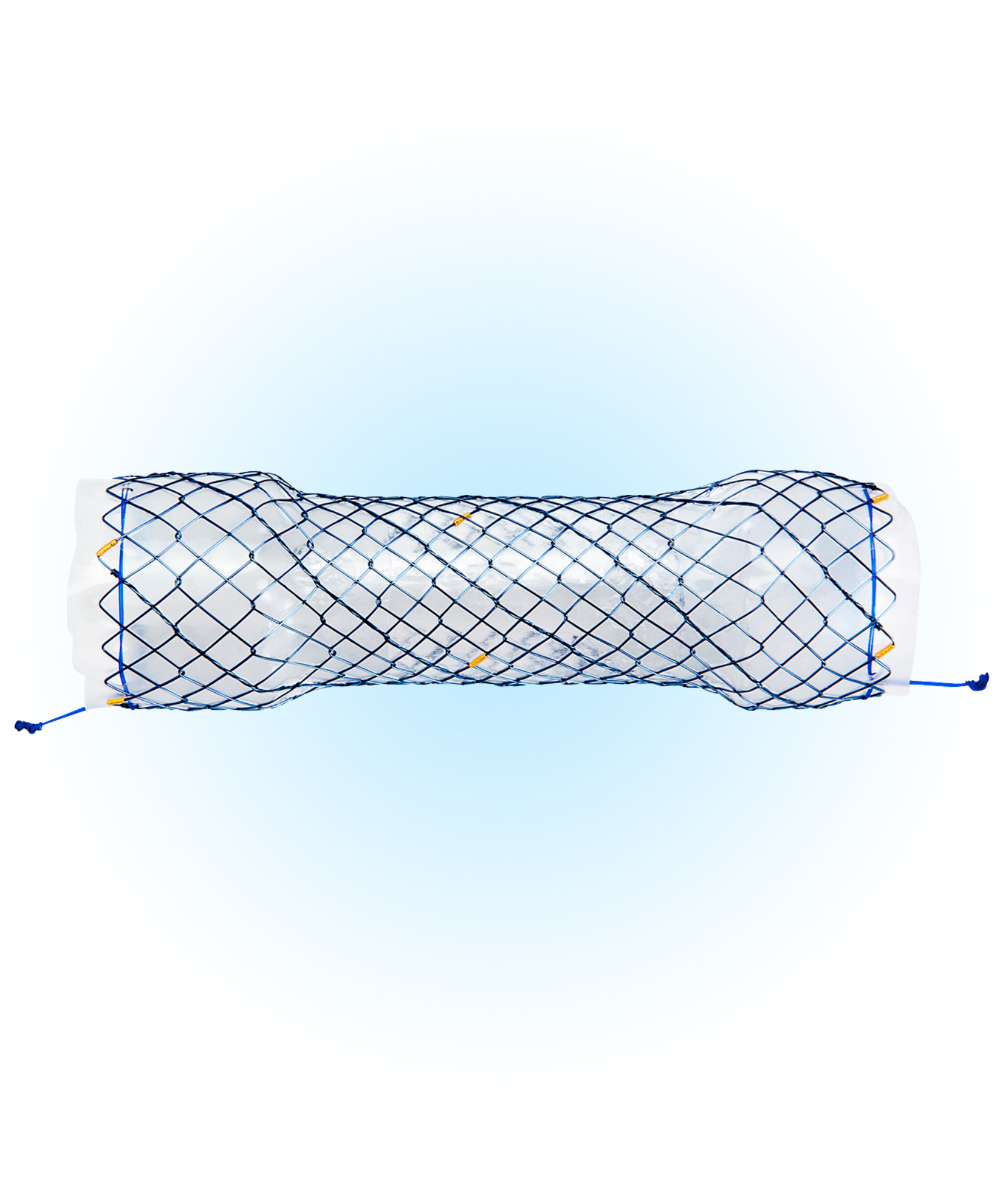 ECV Özefagus Kaplı Stent