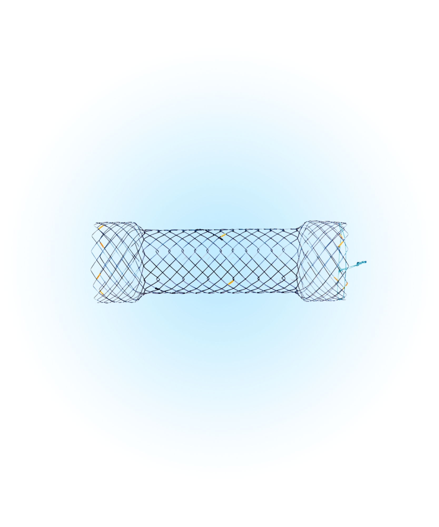 EPBA Özefagus Yarı Kaplı Stent