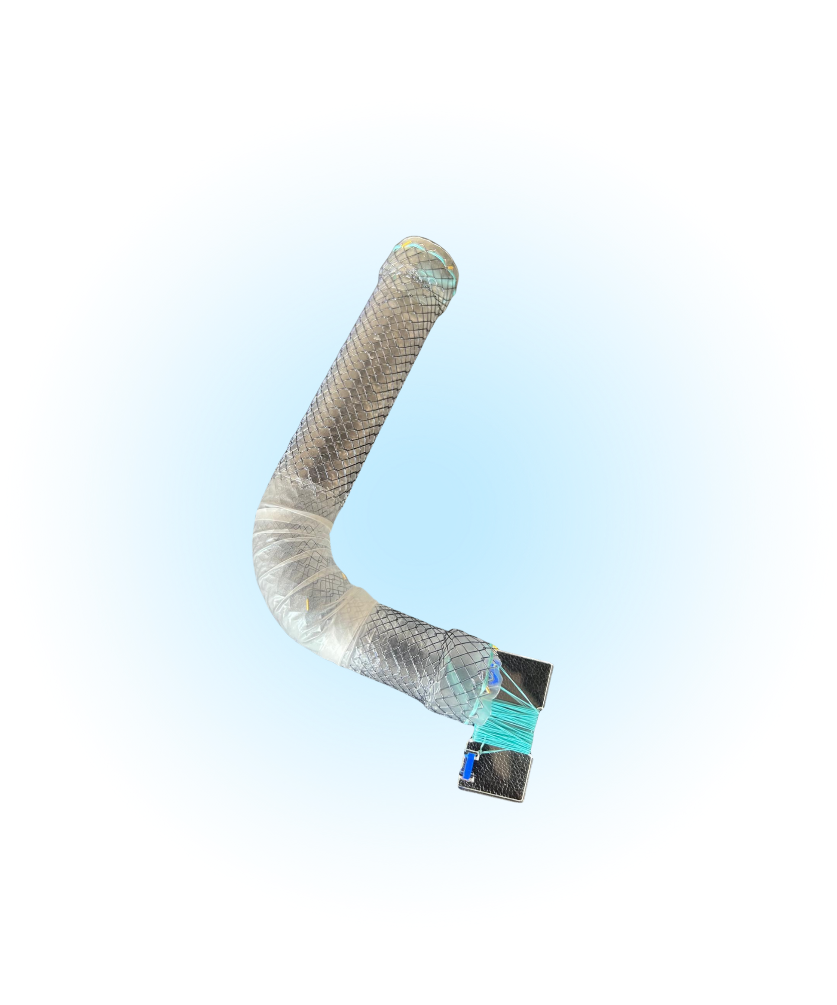 ECBBT Özefagus Kaplı İpli Bariatrik Stent