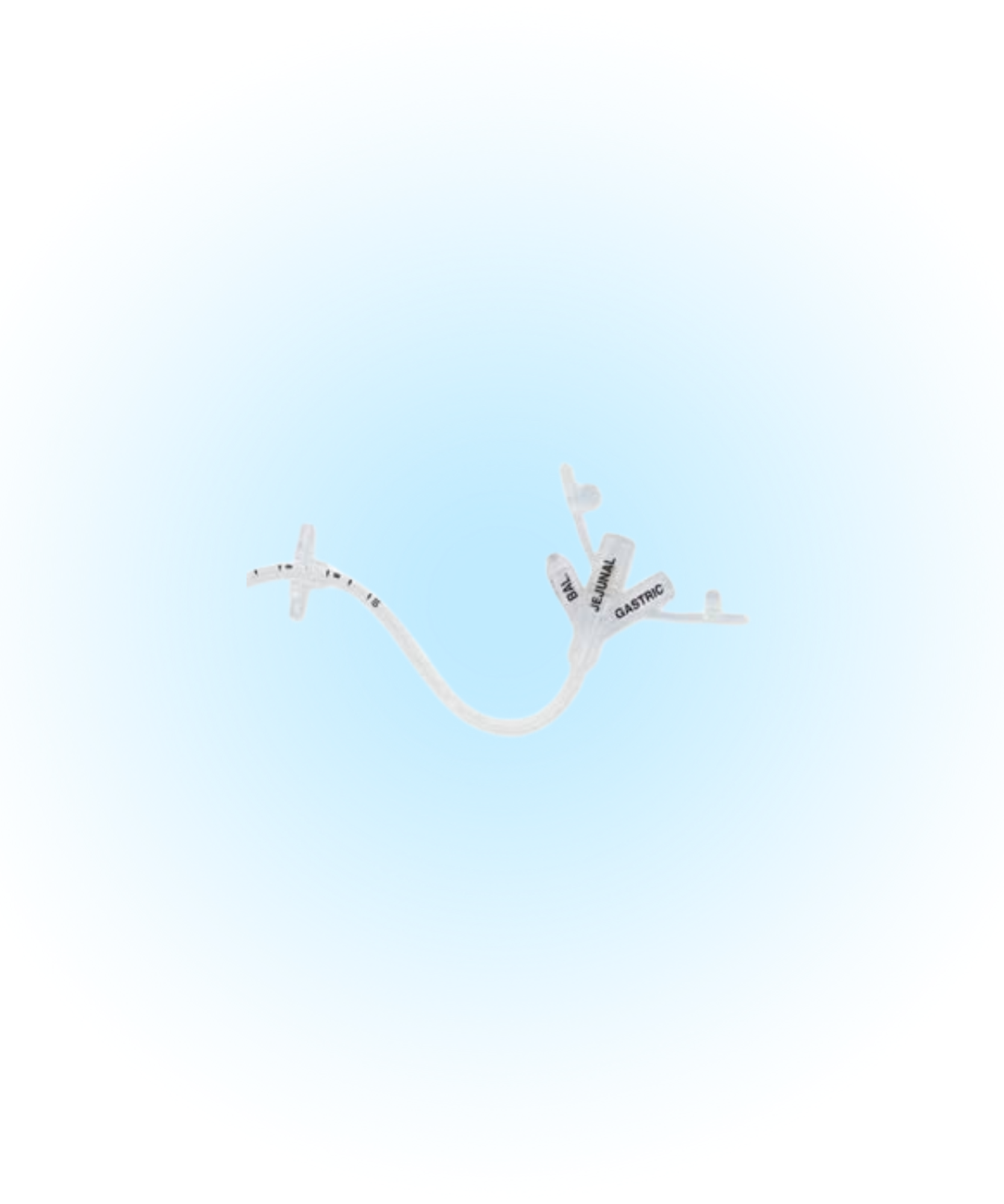 Transgastric Jejunal Feeding Tube
