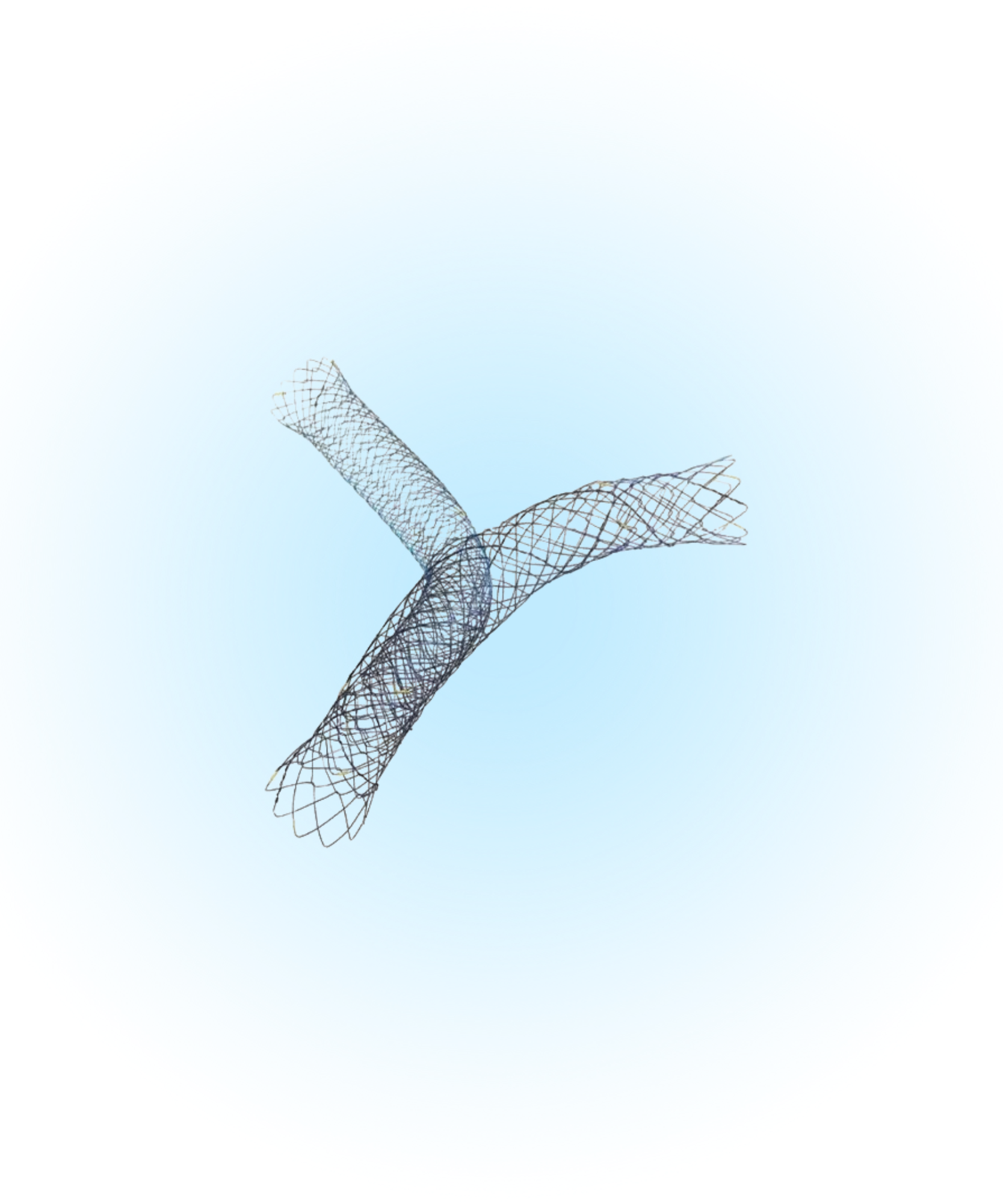 Nonvasküler Kapsız Biliyer Stent